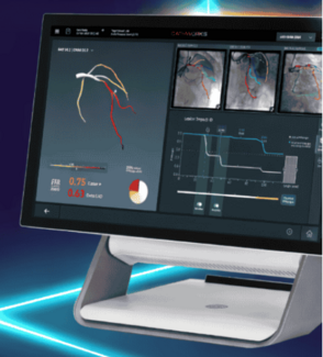 Larger Catheters in Smaller Arteries: Overcoming Obstacles